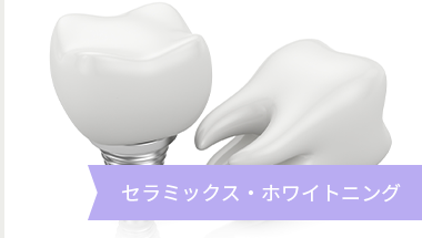 セラミックス・ホワイトニング